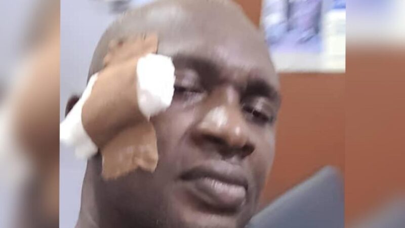 Gover Otti’s Cash Gift: Abia Assembly Members Break Bottle On Colleague’s Head